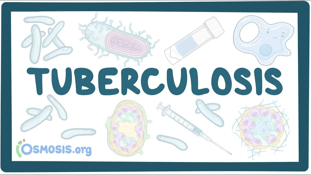 Tuberculosis - causes, symptoms, diagnosis, treatment, pathology
