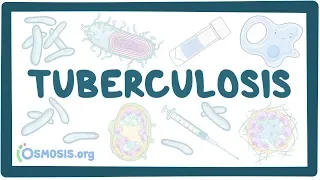 Download Tuberculosis - causes, symptoms, diagnosis, treatment, pathology MP3