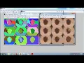 Bagged textural and color features for melanoma skin cancer detection Matlab IEEE project