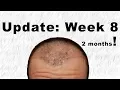 8 Weeks Post Operation