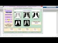 Matlab Code Lung Cancer Detection and Classification Using Image Processing