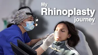 RHINOPLASTY JOURNEY (PART 1) | AWRA BRIGUELA