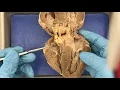 Sheep Heart and Model Anatomy Demo