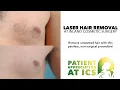 Laser Hair Removal at Inland Cosmetic Surgery