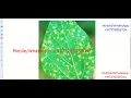Soybean Plant Disease Detection Using Image Processing Python Project With Source Code Soybean Leaf
