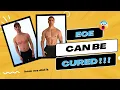Download Lagu Our SECRET to NATURALLY Curing EoE!