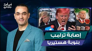 إصابة ترامب بنوبة هستيريا غريبة: 37 تغريدة في ساعتين استبدال خريطة إيران بصورته وتغيير لون شعره فجأة