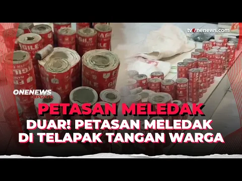 Petasan Meledak saat Dirakit, Telapak Tangan Pemuda Alami Luka Bakar