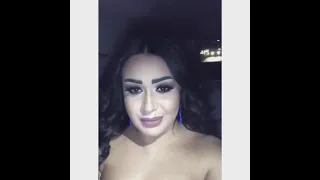 هدلعه دندنها