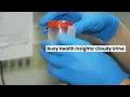 Cloudy Urine Common Causes and When to Seek Medical Care BuoyHealth com