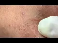 Satisfying and Relaxation with SURI NGUYEN Beauty Spa
