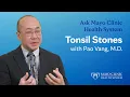 All About Tonsil Stones Ask Mayo Clinic Health System