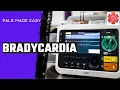 Pediatric Advanced Life Support PALS Bradycardia Algorithm