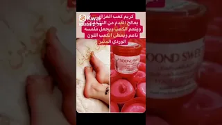 منتج سوري اصلي   كعب الغزال   ترطيب وتنعيم الجلد هو معالج  للايد والركب والكوع ب  الاف فقط دندنها
