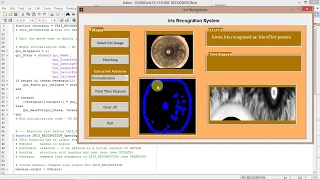 Iris Recognition and Matching Using Image Processing Matlab Project Source Code