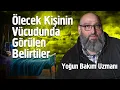 Download Lagu Ölecek Kişinin Vücudunda Görülen Belirtiler - Yoğun Bakım Uzmanı