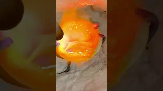 این قسمت مورد علاقه ی منه                                             دندنها