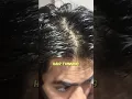 Download Lagu Best hair care routine for men | Hair fall | Hair loss