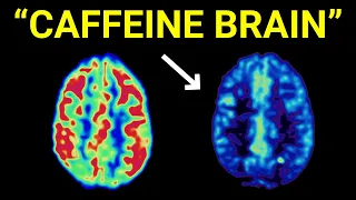 Why Coffee Might Be Destroying Your Brain