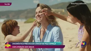 Diagnóstico precoce do câncer de pele começa com atenção aos sinais