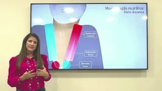 Ortodontia: Movimento de corpo ou efeito alavanca?