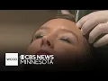 How to tell if your med spa is giving proper safe treatments