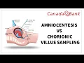 Amniocentesis vs Chorionic Villus Sampling Key Differences Indications Risks High-Yield