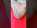 Download Lagu Repair Cracked Heels In 1Day | Get Rid Of Cracked Heels #feet #cracked #heels #shorts #youtubeshorts
