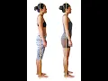 Forward head posture can cause dementia
