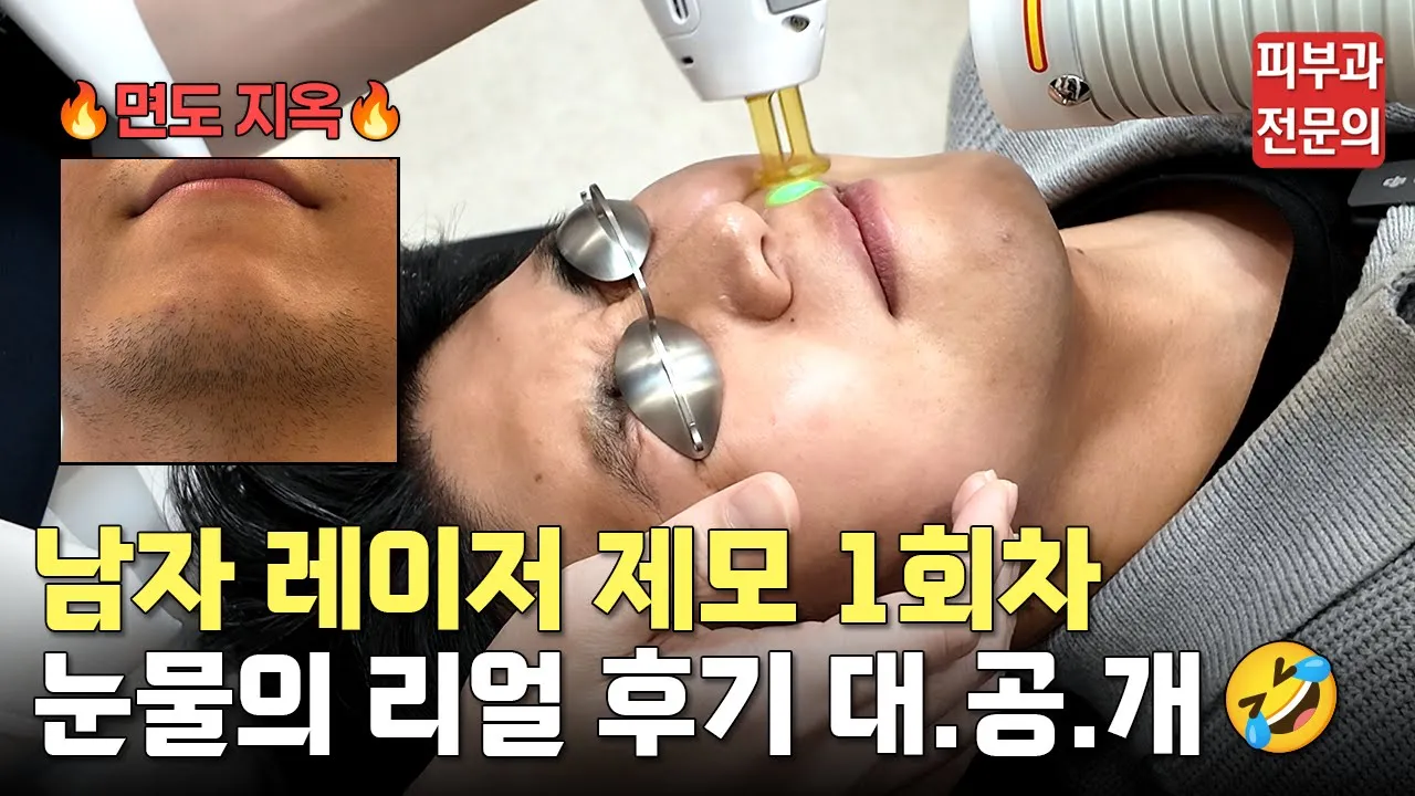 제모 시술 A to Z 진료부터 시술까지 모두 공개!🙌ㅣ레이저제모, 남자제모, 여자제모, 제모기계, 레이저제모 후 면도, 레이저제모 1회차, 면도, 주의사항, 여름