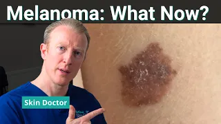 The 5 Stages of Melanoma What Each One Really Means