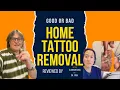 Home tattoo Removal Using Salt Reviewed by Dr Messina Dr Youn Is It Safe