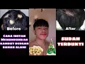 Download Lagu TIPS MENUMBUHKAN RAMBUT, MELEBATKAN SEKALIGUS MELEMBUTKAN RAMBUT|| instan, cepat \u0026 Alami