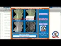 Detection of Maize Leaf Disease Using Image Processing With Source Code Matlab Project Code