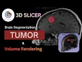 Brain Segmentation with 3D Slicer Tumor Volume Rendering