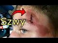 Download Lagu PRZEŻYŁEM WYPADEK BEZ KASKU NA QUADZIE *miałem szczęście*
