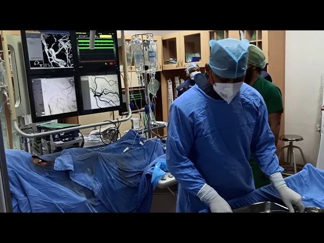 MCA Aneurysm Coiling