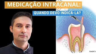 Medicação Intracanal, Quando devo indicá-la?