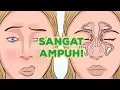 Download Lagu Tips Mengatasi Hidung Tersumbat Dengan Cara Ampuh Ini !