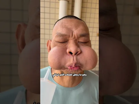 لماذا ينتفخ فمه هكذا؟ 🤔