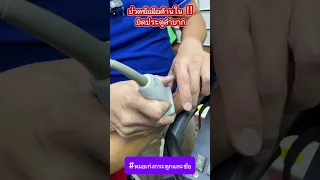  อาการเจ็บที่ข้อมือด้านในใกล้ข้อเท้า เกิดจากอะไร 