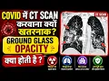 is ct scan required for covid 19 Ground glass opacity covid 19