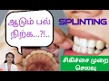 Lagu ஆடும் பல் நிற்பதற்கு//Splinting teeth@natpudandoctor6080
