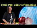 Onion Peel Under the Microscope How to Prepare Stained Temporary Mount of Onion Peel