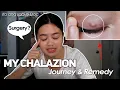 Lagu MY CHALAZION JOURNEY AND REMEDY / ANG PAYO NI DOC
