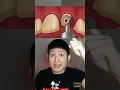 Download Lagu GIGI COWOK INI HANCUR DIMAKAN ULAT | Yosua Andre #alurcerita #shortvideo #shorts