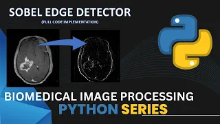 Sobel Edge detector Python Code implementation Image Processing Computer vision