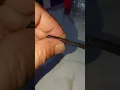 Earshock Crosslink Zero replacement