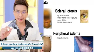การทำ intermittent fasting ช่วยรักษาไขมันพอกตับได้จริงหรือไม่