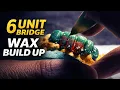 Lower 6 Unit Bridge Wax Pattern Build Up Full Process Step by Step